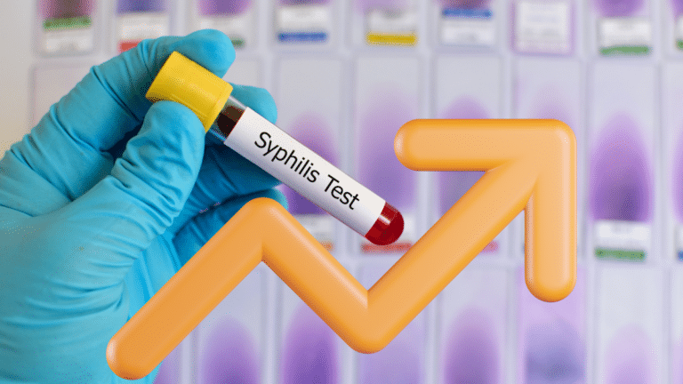 Syphilis rises in Japan