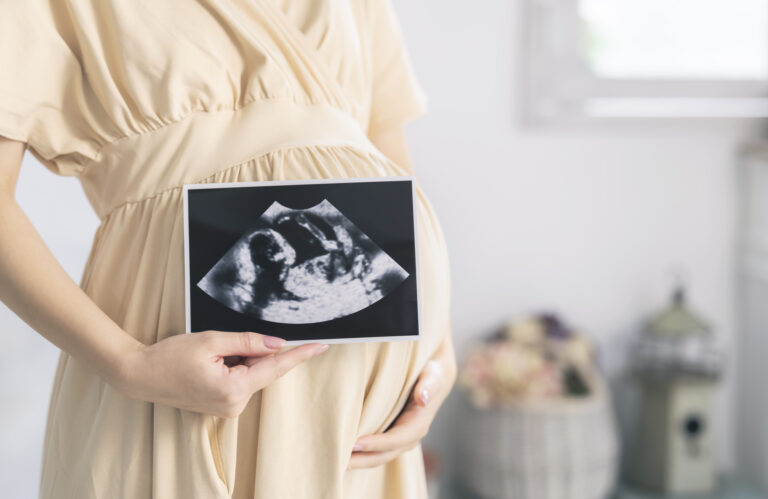 Pregnant woman in a dress holding ultrasound in front of her stomach